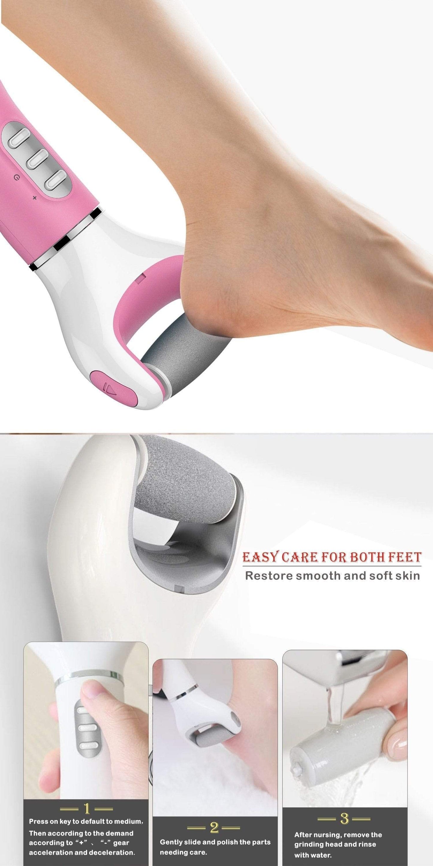 Impact Shop Callus Remover