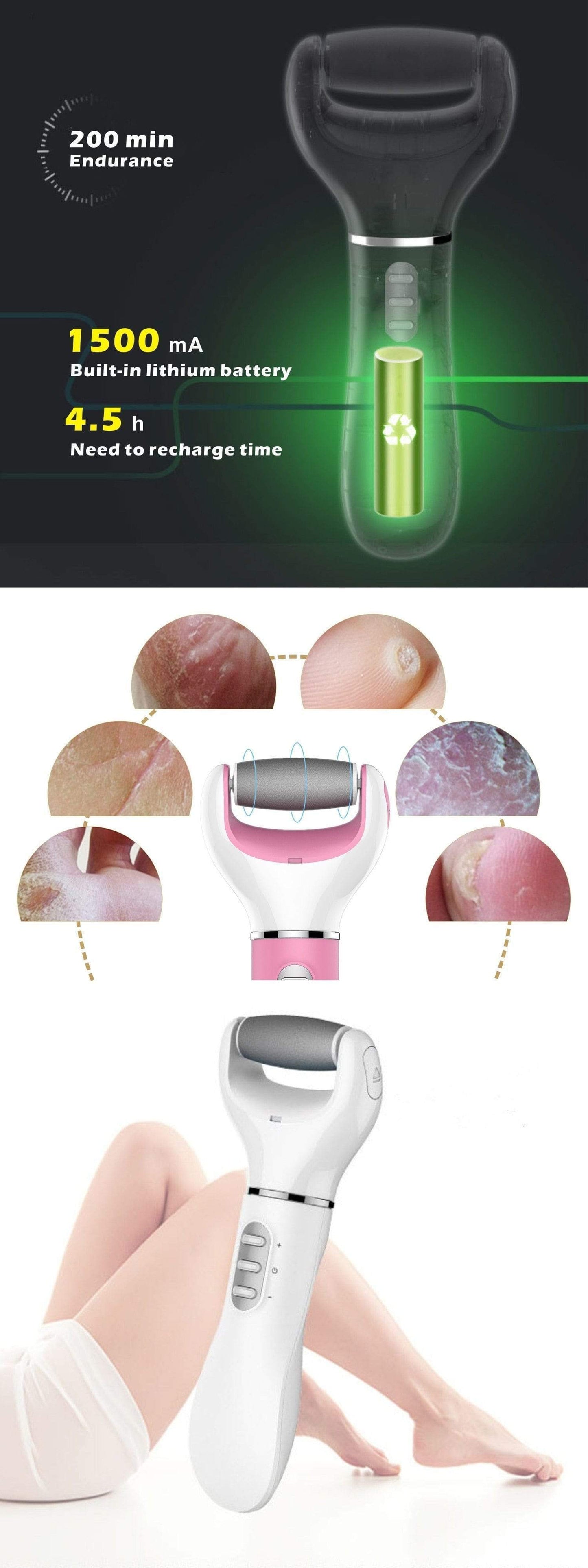 Impact Shop Callus Remover