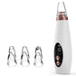 Blackhead & Pore Vacuum