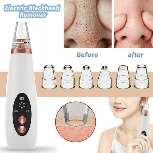 Blackhead & Pore Vacuum